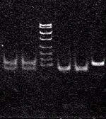 A TNF-a gén pontmutációja RFLP (Restriction Fragment Length Polymorphism) 1/2 1/2