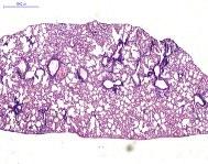 neutrofil és limfocita beszűrődésekkel (5.ábra). Kontroll 1000µm 100µm 2 hónap dohányzás 100µm 1000µm 5.