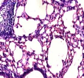 után. 10x nagyítás, 20x nagyítás, lépték:100 µm, 1000 µm. A nyilak a limfoid beszűrődésre mutatnak.