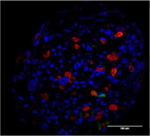 CFE  20µm