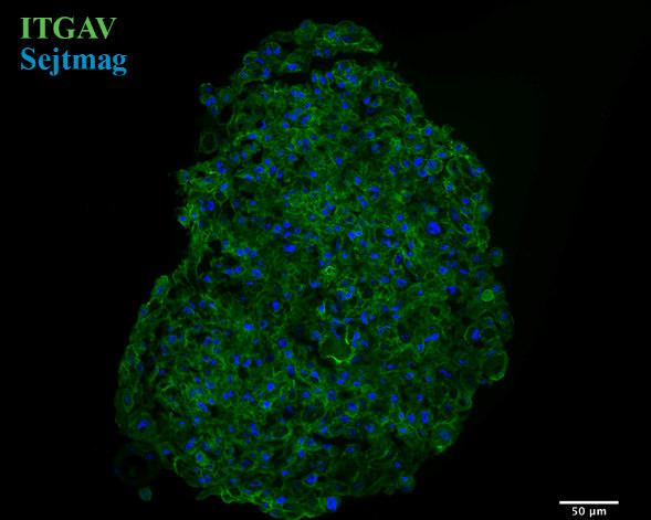 rhwnt4