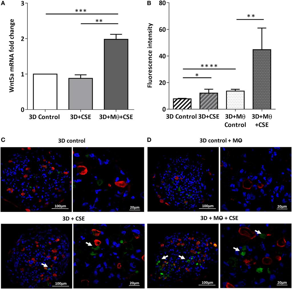 Feller et al. Systemic Inflammation Induced by Cigarette Smoke FIGURE 1 Effects of cigarette smoke (CS) on C57BL/6 mouse lungs.