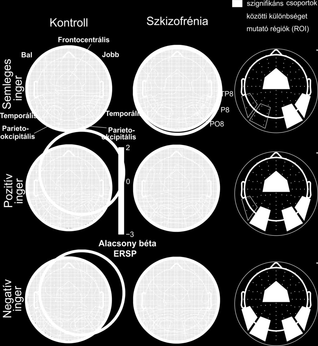 8. ábra Az alacsony béta ERSP skalpra vetített topográfiai ábrázolása a három vizsgálati kondíció és a két vizsgálati csoport estében a második időablakban (900 1100 ms).