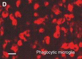 amoeboid