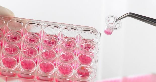 tanulmányozása MTT vizsgálat: a kivonatok bélhámsejtekre való ártalmatlanságának