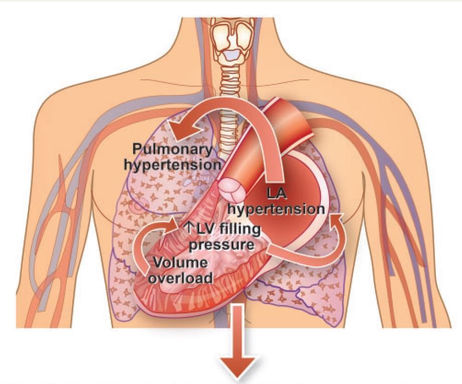 mechanisms to therapies