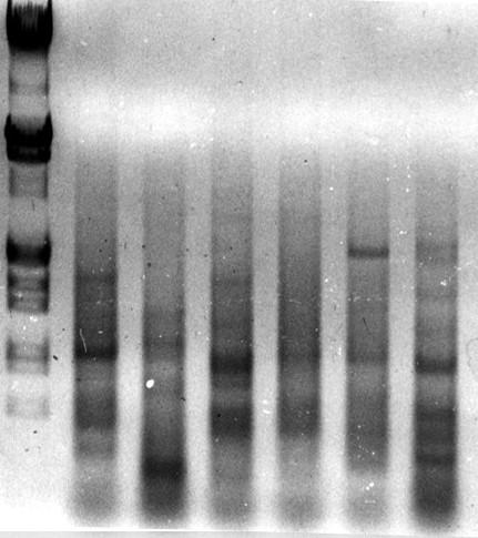 kb M 1 2 3 4 5 6 21,2 5,1 4,9 3,5 2,0 1,9 1,7 1,3 0,9 0,8 0,5 Figure 42 : Amplification PCR des ADNs complémentaires des ARNm en utilisant les amorces réo et soit B1oligoa1 (ligne 1), soit B1oligoa2