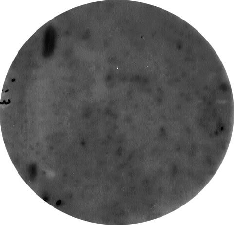 Clone 4 Clone 5 Clone 3 Clone 2 Signal positif peu spécifique Clone 6 Clone 1 a b Figure 43 : Autoradiographie de deux membranes de nylon contenant des phages