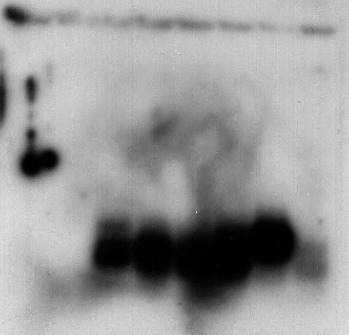 ligation. L ADN amplifié est déposé sur un gel d agarose 0,8%, séparé par électrophorèse et coloré au BET (ligne 1 à 6).