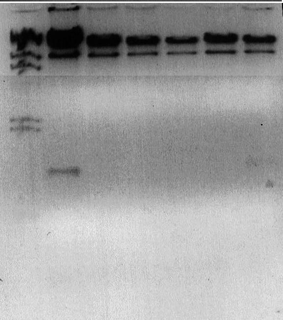 kb M 1 2 3 4 5 6 M 1 2 3 4 5 6 23,1 9,4 6,5 2,3 2,0 a b Figure 47 : a) L ADN de 6 clones purifiés après