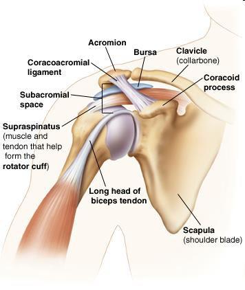 Impingement syndroma ROK elégtelen működés A kar emelésekor a Tuberculum majus az acromionba
