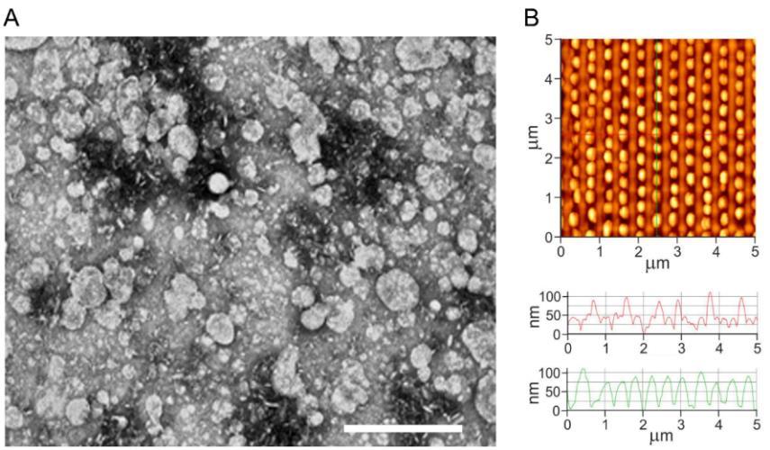 9. ábra. (A) Nioszómák transzmissziós elektronmikroszkópos és (B) atomerő mikroszkópos képe. Mérce: 500 nm. A nioszómák stabilitását fél éven keresztül követtük.
