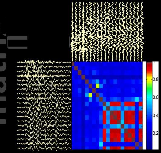a) b) 1. ábra. A hullámforma korreláció elemzés eredményének kétféle grafikus megjelenítése: a) kereszt-korrelációs mátrix és b) a dendrogram Figure 1.
