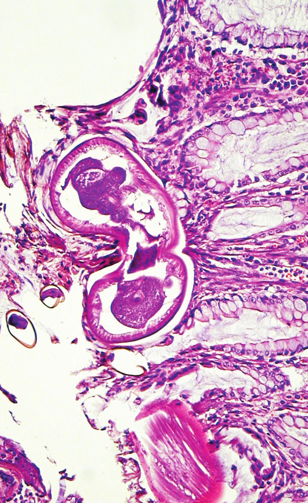 MAGYAR ÁLLATORVOSOK LAPJA Hungarian Veterinary Journal Vol. 141. No. 6. - Budapest, June 2019. Established by Prof. B. Nádaskay, 1878 Trichuris vulpis kutya vastagbelében 2019 / 6. 141. évfolyam 321-384.