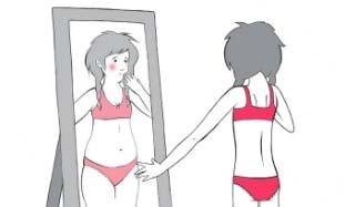 Az anorexiás beteg testképe torzult, indokolatlanul túl