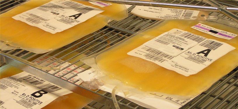 Trombocita készítmények dózisa osztottnál: 10-20 ml/kg 10-20 ml/kg/óra Aferezises: 0,5 x 1011 tromb.