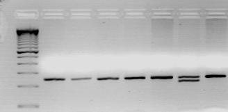 28. ábra: A TLR4 +896-os lokuszának PCR-RFLP vizsgálata. M 1 2 3 4 5 6 7 Reprezentatív ábra a TLR4 +896-os lokuszának polimorfizmus vizsgálatáról.