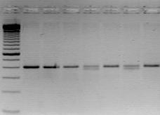 30. ábra: A CARD15 +2722-es lokuszának PCR-RFLP vizsgálata. M 1 2 3 4 5 6 7 Reprezentatív ábra a CARD15 +2722-es lokuszának polimorfizmus vizsgálatáról.