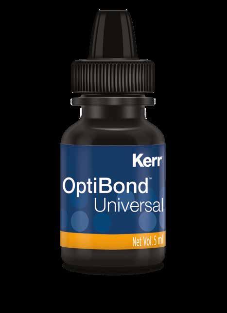 Az OptiBond Universal egykomponensű adhezív minden ragasztást igénylő esetét megoldja.