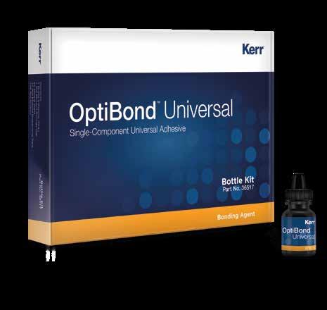 OptiBond Universal Egy flakonos, egy lépéses univerzális bond akár önsvazásos, akár szelektív savazásos vagy akár teljes