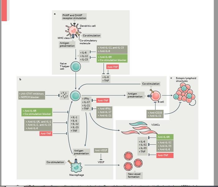 Nagyér vasculitisek GCA giant cell arteritis Pathomechanizmus: Adventitia érintett először Aktivált dendritikus sejtek,