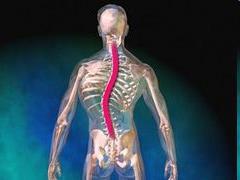 Strukturális scoliosis Processus spinosusok a