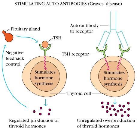 Grave-kór A Grave kór hátterében a thyroidea-stimulláló hormon (TSH) receptor ellen termelődött autoantitestek állnak.