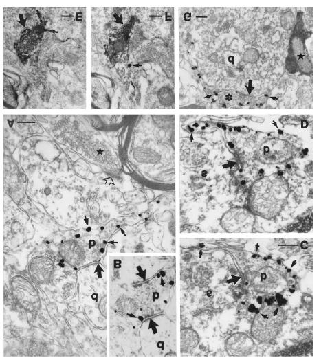 4. ábra. A-D) Az intracelluláris COOH-terminális epitóp elleni antitesttel festett CB 1 receptor szubcelluláris eloszlása.
