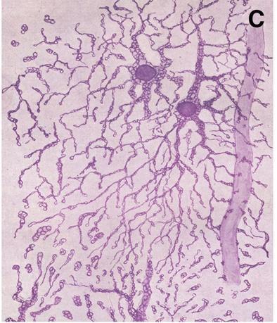 B, C : Astrocytes in the stratum lucidum of the human CA1 area of the