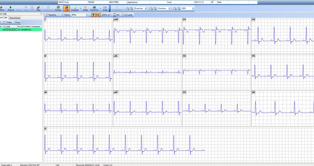 LEHETŐSÉG AZ EKG