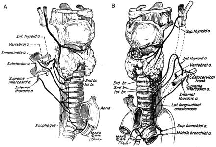 Trachea C.VII Th. IV 12-15 cm hosszú 2-2.
