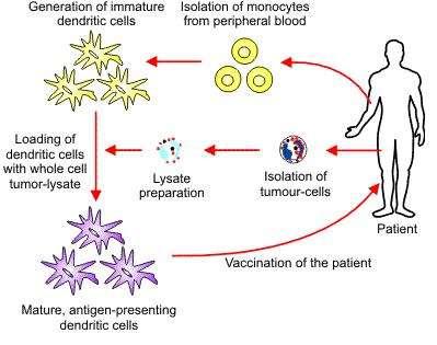 Dendritikus sejtek (DC) alkalmazása tumor-terápia során éretlen DC-k előállítása in vitro monociták izolálása vérből a DC-k feltöltése tumorantigénekkel lizátum