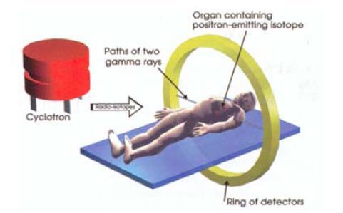 PET (Positron Emission Tomography)