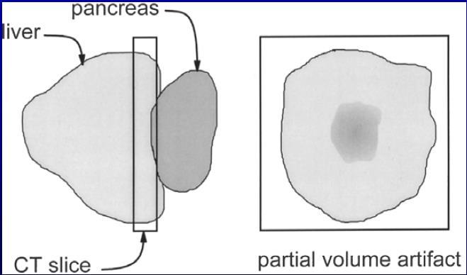 Parciális térfogat hatás Egy voxel több különböző szövetet tartalmazhat az elnyelési együtthatók