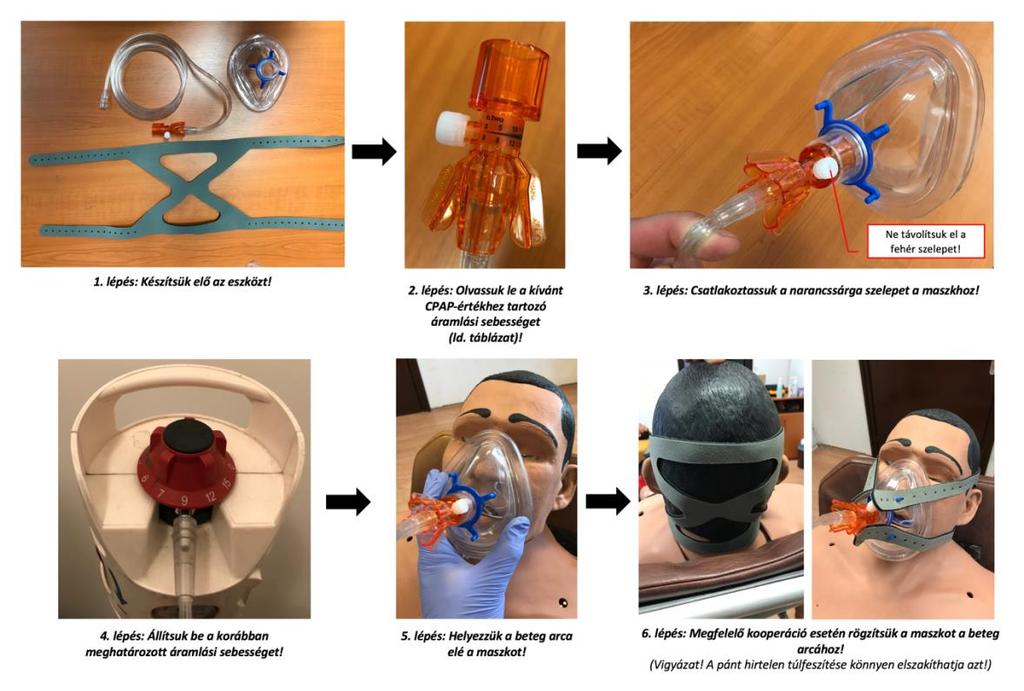 15 l/perc) PEEP-szelep Rezervoár Szelep Az O-Two használata: Az O-Two beállításai: CPAP (vízcm)