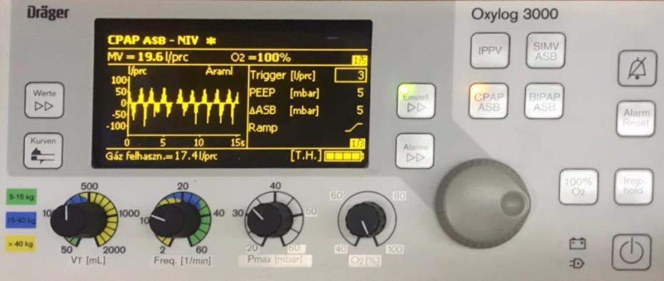 Oxylog 3000 kezdeti beállításai noninvazív lélegeztetéshez CPAP +