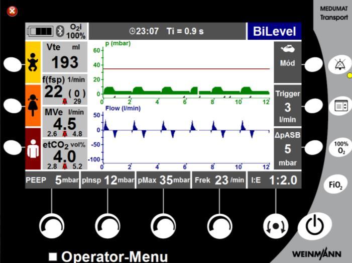 Trigger: 3 l/min pasb: 5-8 mbar PEEP: 5 mbar FiO 2 : kezdetben 100% P max : 35-45 mbar T i :