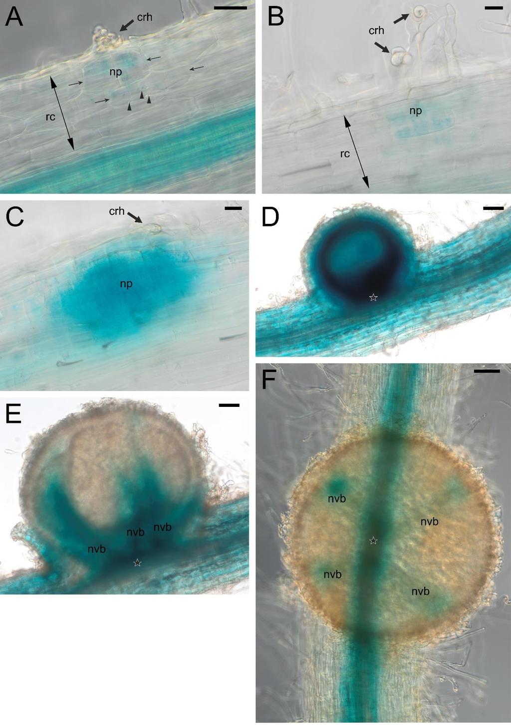 Figure S10. The pattern of LjPIN4 expression in the initial (A, B, C) and emerged (D) root nodule primordia and in juvenile, 20 dpi, nodules (E, F).