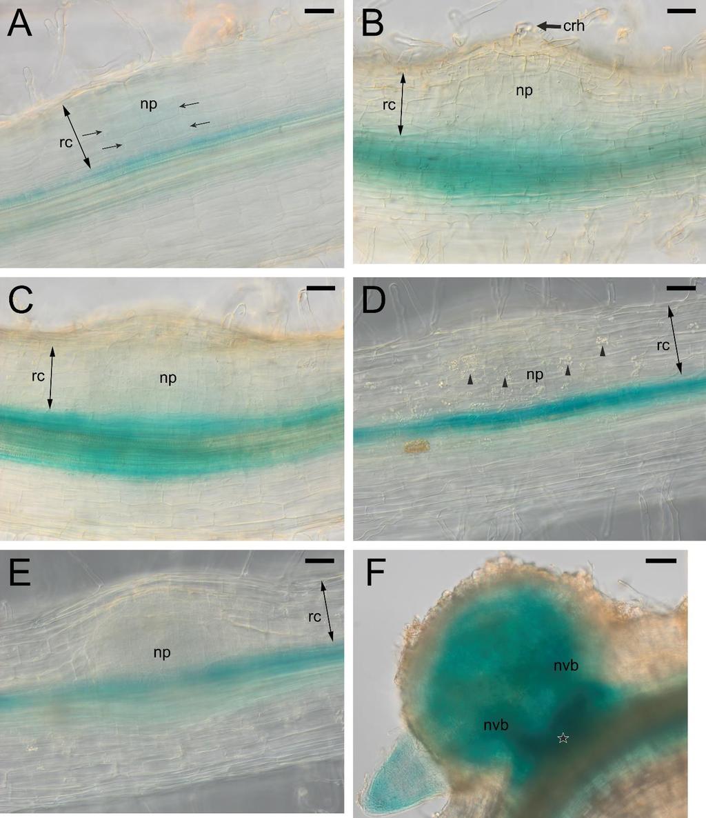 Figure S11. The pattern of LjPIN5 expression in the initial (A), hidden (B, C, D, E) and emerged (F) root nodule primordia.