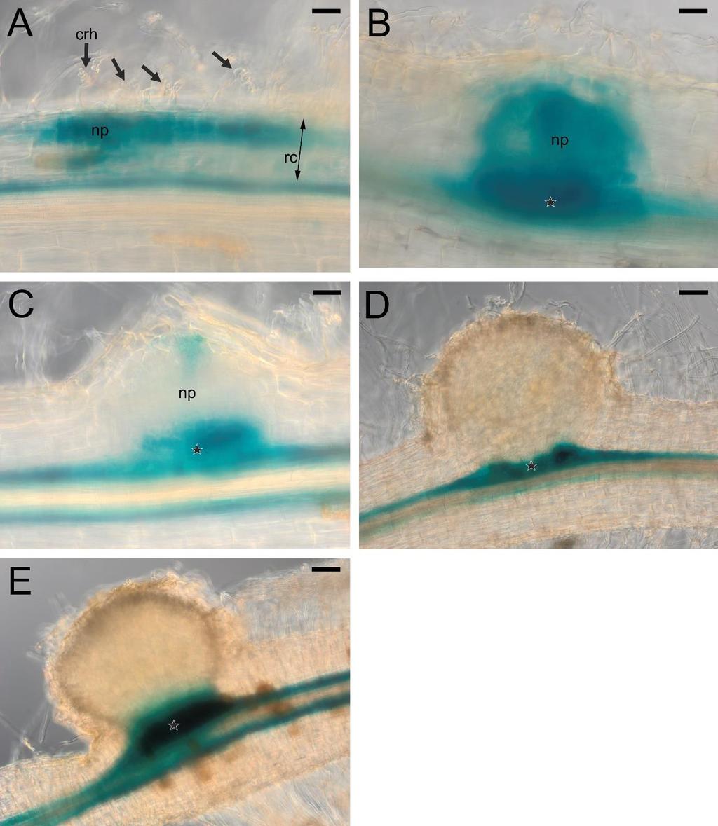 Figure S9. The pattern of LjPIN3 expression in the initial (A), "hidden" (B), "emerging" (C) and emerged (D) root nodule primordia and in juvenile, 20 dpi, nodules (E).