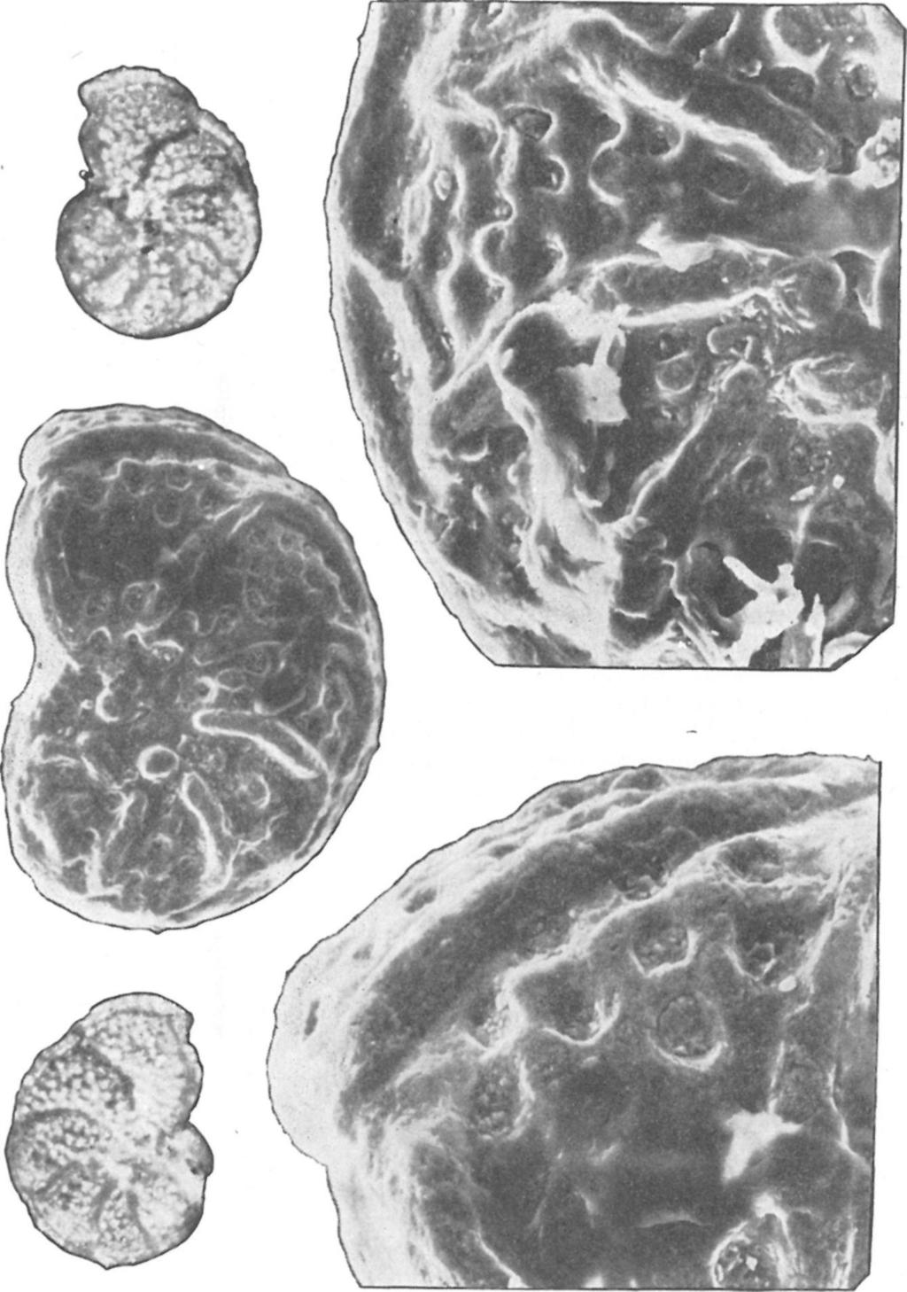 jajainak électroscanning