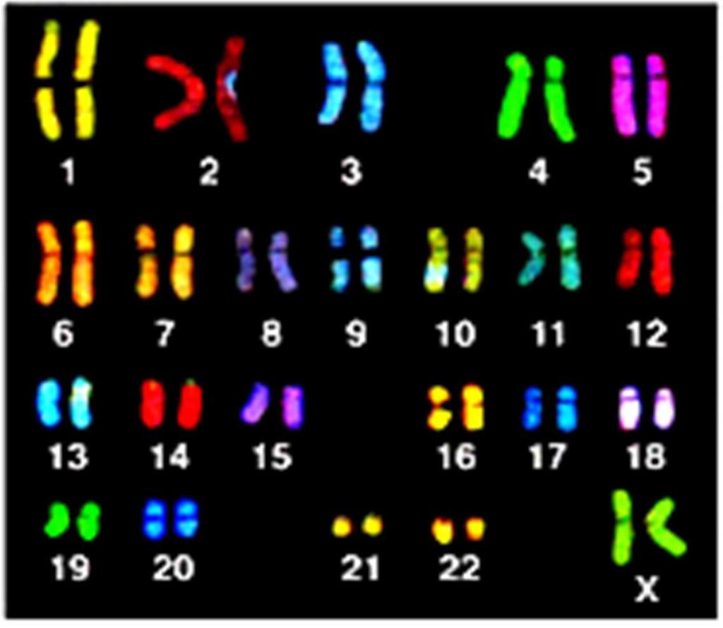 Vörösvérsejt antigéneket kódoló gének kromoszóma lokalizációja (Mendeli genetika) 22 autoszomális + 1 nemi (x; y) kromoszómapár X nemi kromoszóma 21.1 p22.