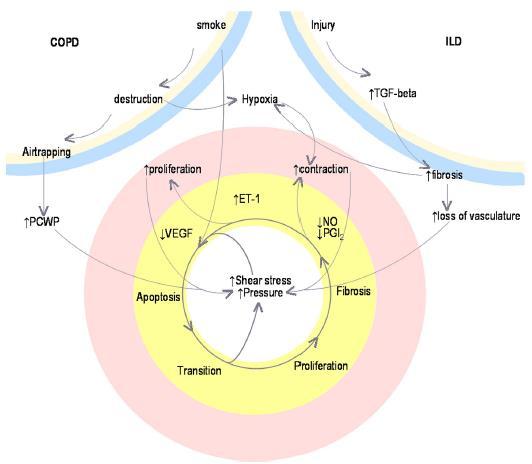 A pulmonális hypertónia