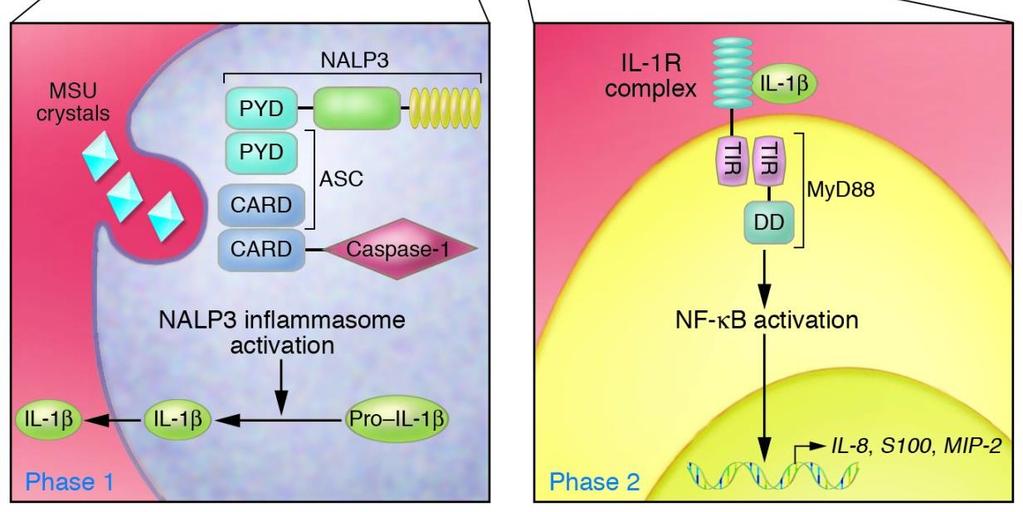 IL-1β túltermelés