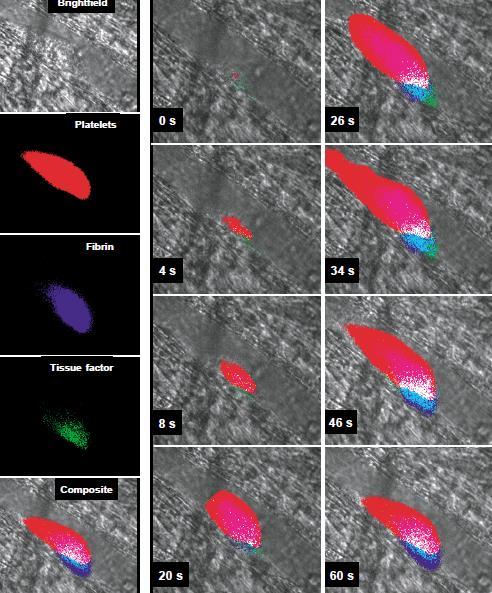 arterial thrombus formation in the mouse SHAHROKH FALATI, PETER GROSS, GLENN