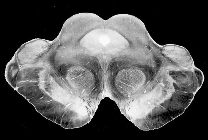 Colliculus superior