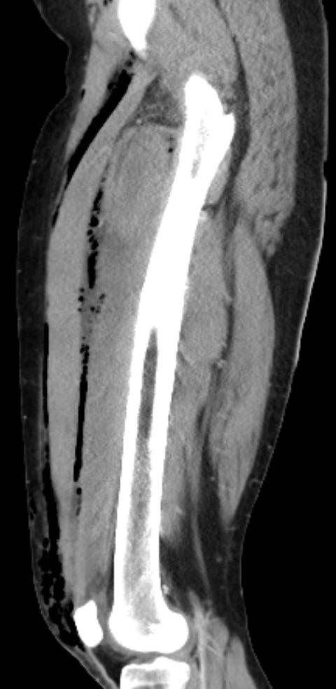 radiologyassistant.