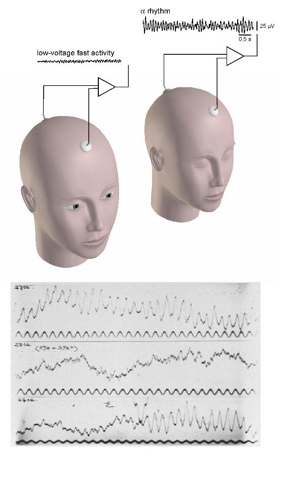 EEG Ébrenlét-feszült figyelem - β/γ (20-80 ( Hz) Nyugodt ébrenlét - α (8-13( Hz) CX LA 1 - θ (3-7 Hz) -60 mv LA 2 lassu