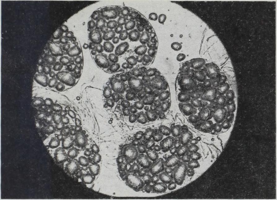 így lehetővé válna a feldolgozott termékek előfőzéskövekeztében fellépő tápanyag-veszteségének és vitaminjai hőinaktiválódásának csökkentése, a bébiételek tápértékének egyidejű növelésével.