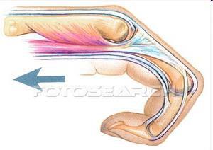 M. flexor digitorum sup. et prof. M.